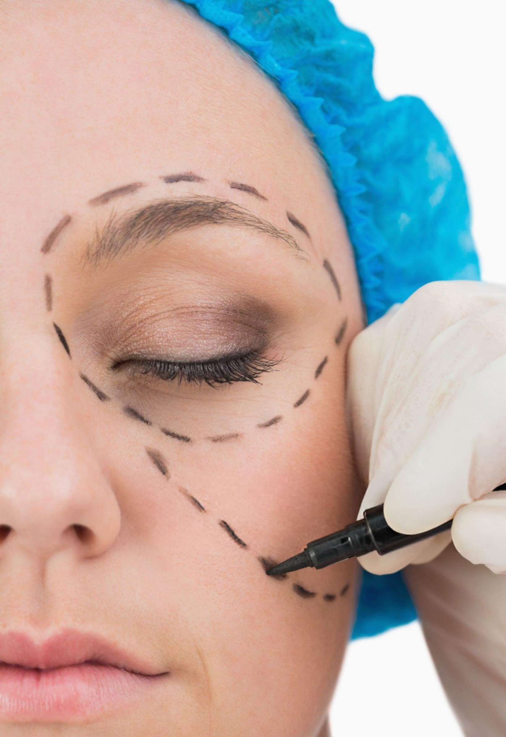 Professional 8-point facelift treatment being administered to a woman